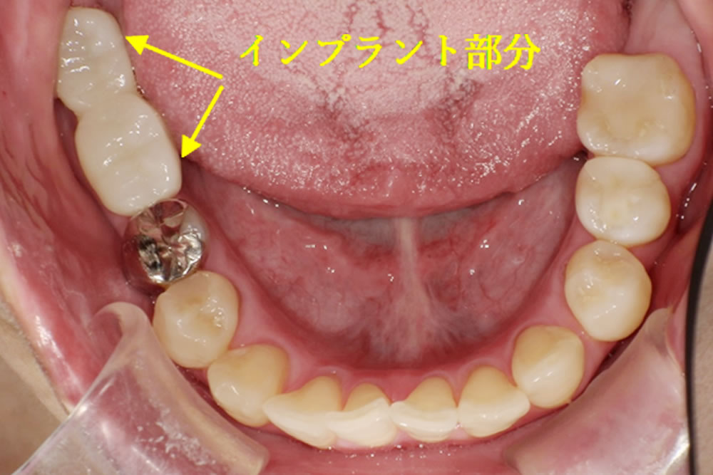 治療完了