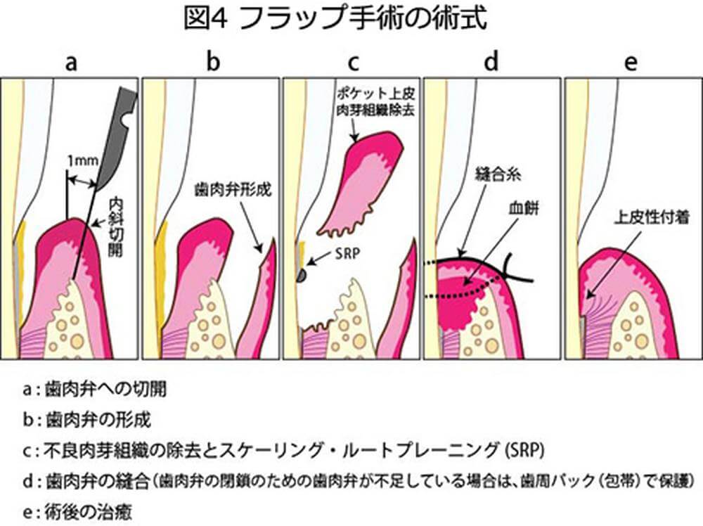 リグロス