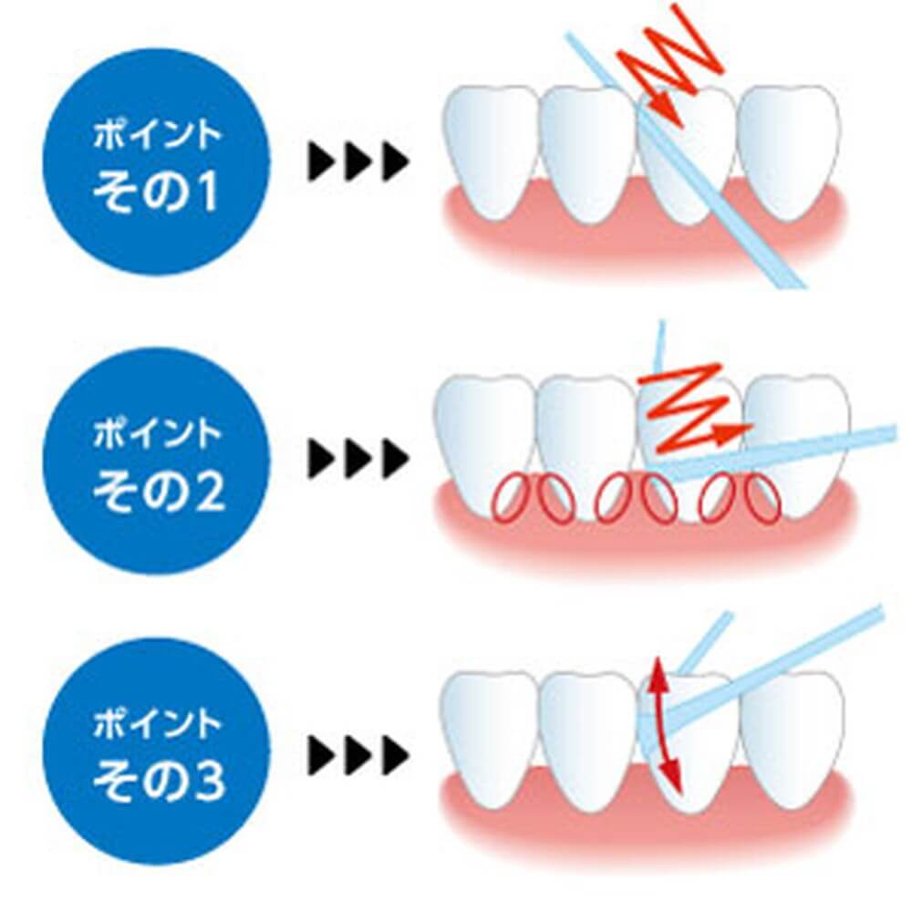 フロス 通す と 痛い 虫歯