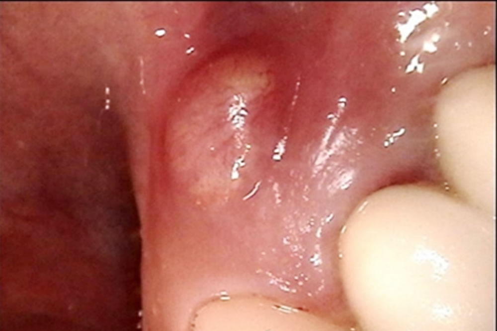 初診時の口腔内
